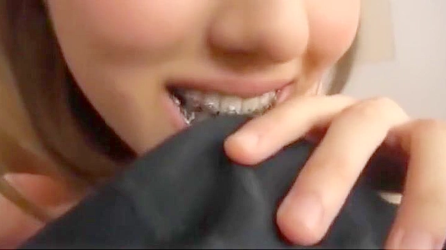 Revealing the Alluring World of Braces Fetish and Mouth Fetish with Friends